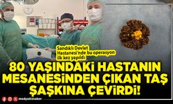 80 yaşındaki hastanın mesanesinden çıkan taş şaşkına çevirdi!