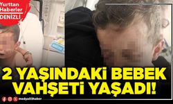 2 yaşındaki bebek vahşeti yaşadı!