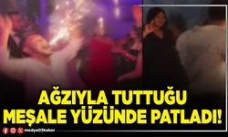 Ağzıyla tuttuğu meşale yüzünde patladı!