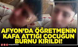 Afyon’da öğretmenin kafa attığı çocuğun burnu kırıldı!