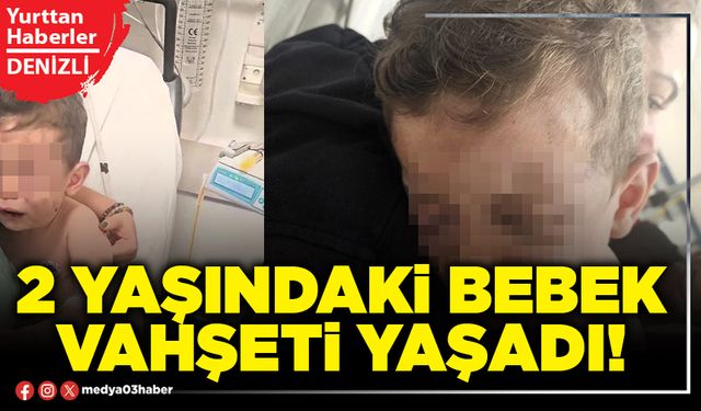 2 yaşındaki bebek vahşeti yaşadı!