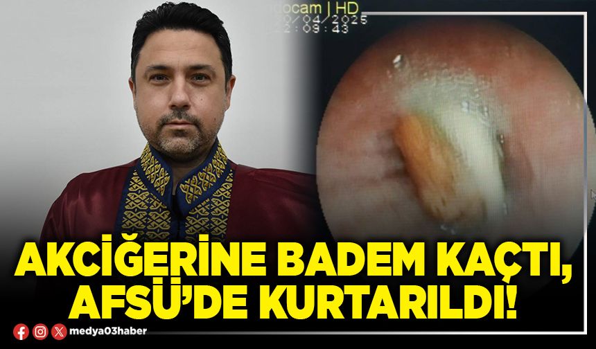 Akciğerine badem kaçtı, AFSÜ’de kurtarıldı!