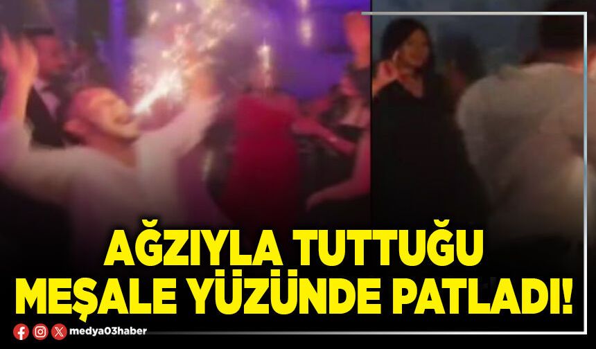Ağzıyla tuttuğu meşale yüzünde patladı!