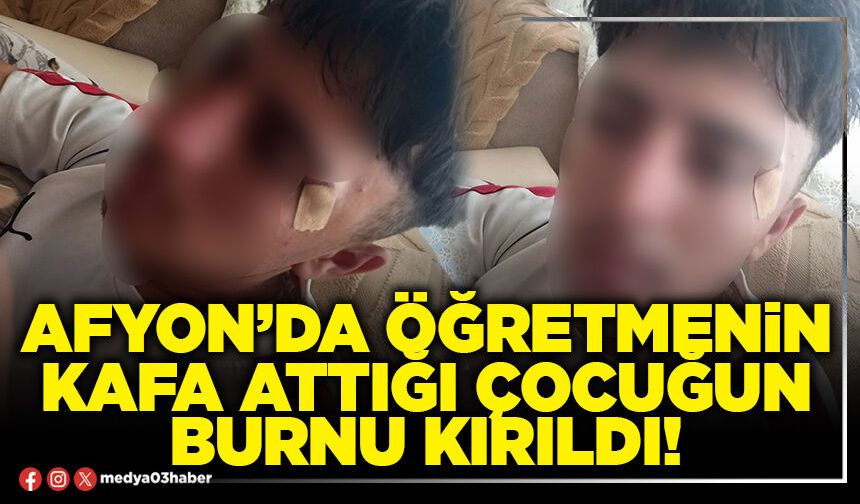 Afyon’da öğretmenin kafa attığı çocuğun burnu kırıldı!